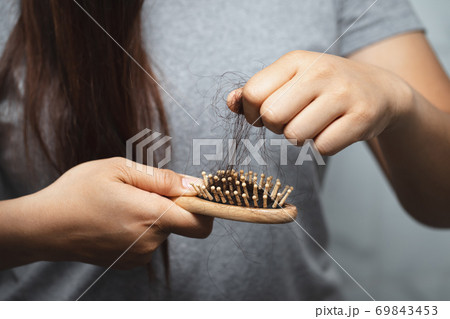 Women with hair loss Because she is allergic to shampoo 69843453