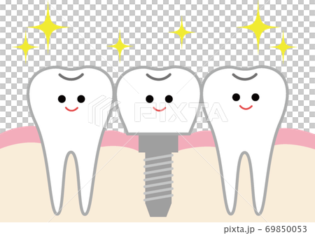 かわいいインプラントの構造についてのイラスト 69850053