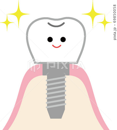 かわいいインプラントのイラスト 69850058