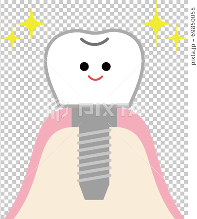かわいいインプラントのイラスト 69850058