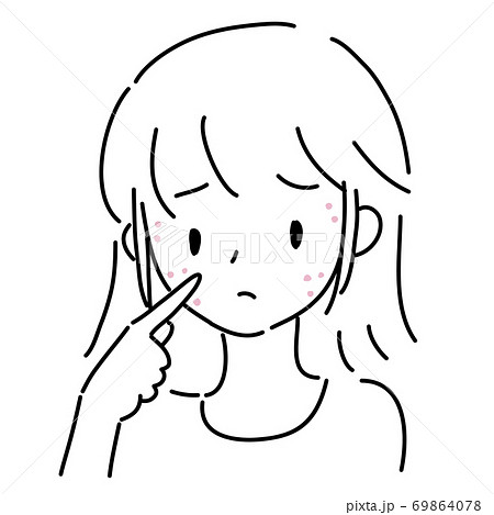 ニキビに悩む若い女性 ニキビに悩む若い女性 69864078
