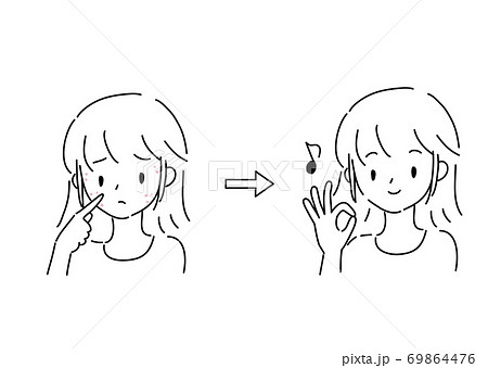 ニキビに悩む若い女性　ビフォーアフター 69864476