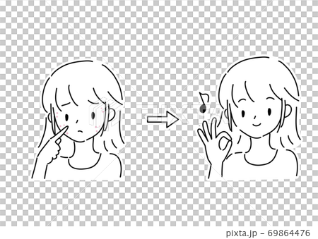 Young woman suffering from acne before and after 69864476