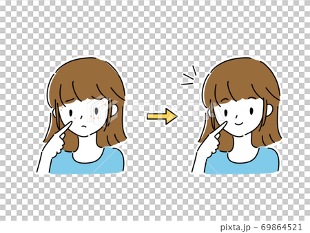 顔イボに悩む女性　ビフォーアフター 69864521