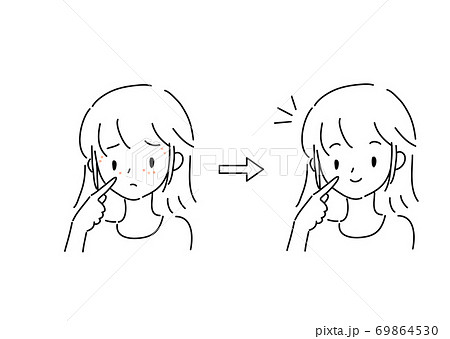 顔イボに悩む女性 ビフォーアフター 顔イボに悩む女性 ビフォーアフター 69864530