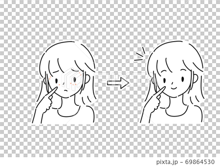 顔イボに悩む女性 ビフォーアフター 顔イボに悩む女性 ビフォーアフター 69864530