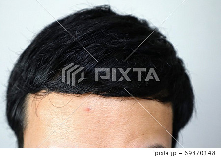 薄毛を髪型でごまかす若い男性のクローズアップの写真素材 薄毛を髪型でごまかす若い男性のクローズアップの写真素材