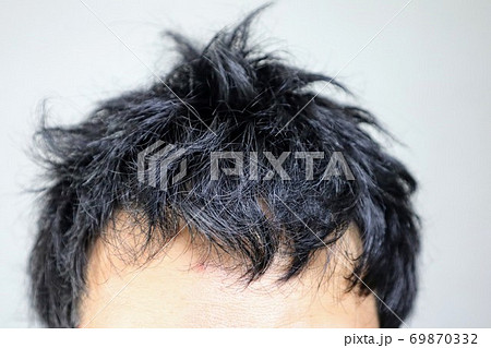 寝起きで髪がボサボサの薄毛の男性の写真素材