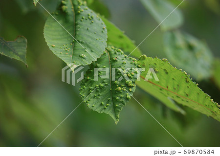 虫瘤 虫瘤 69870584