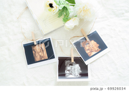 3D超音波写真(人物なし) 3D超音波写真(人物なし) 69926034