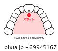 舌スポット 図解 69945167