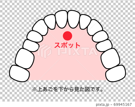 舌スポット 図解 69945167