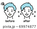 ホワイトニング ビフォーアフター（男性） 69974877