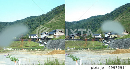 緑内障のイメージ視野が欠ける。 緑内障のイメージ視野が欠ける。 69976914