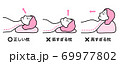 正しい枕 低すぎる枕 高すぎる枕（女性） 69977802