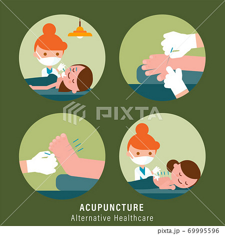 Acupuncture Alternative healthcare illustration Acupuncture Alternative healthcare illustration 69995596