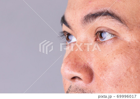 Face skin of asian man to show many skin problem. Men skin care concept on grey space background Face skin of asian man to show many skin problem. Men skin care concept on grey space background 69996017