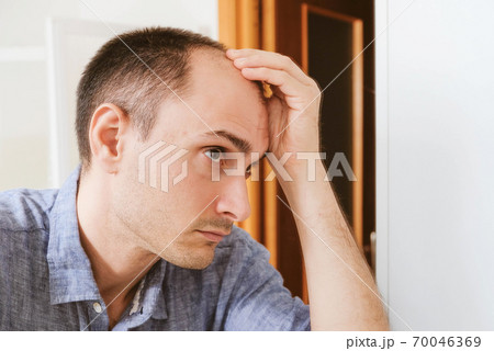 Young man looking at mirror worry about balding. Young man looking at mirror worry about balding. 70046369
