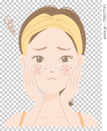 Women's skin care B_14 Women suffering from rough skin 70057743