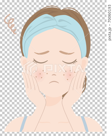 Women's skin care A_15 Women suffering from rough skin 70060193