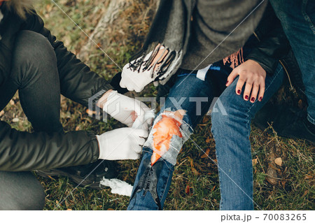 Two boys help a woman with a leg injury Two boys help a woman with a leg injury 70083265