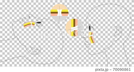 Face lift explanatory diagram Ligament SMAS 70090861