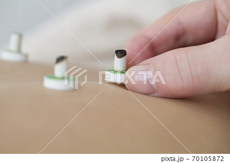 鍼灸イメージ 70105872