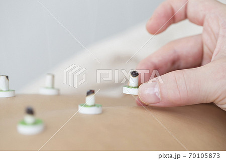 鍼灸イメージ 70105873