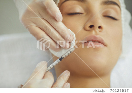 Therapists hands injecting filler botox for correction upper lip of young woman 70125617