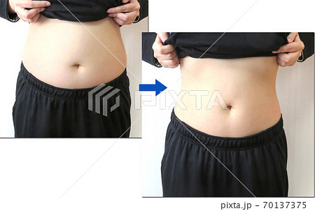 ダイエットビフォーアフターの写真素材