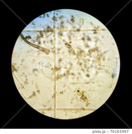Phytoplankton cells. The picture was taken with an optical microscope by camera. Phytoplankton sample in Russia, Primorsky Krai, Sea of Japan, Vostok Bay, 2009 70163997