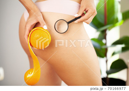 Cellulite problem concept, young woman holding orange near her leg Cellulite problem concept, young woman holding orange near her leg 70166977