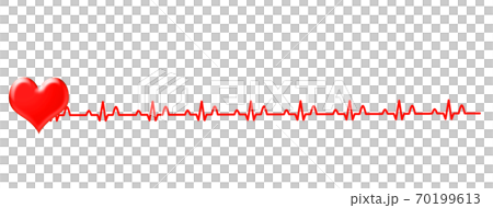 心電圖波形 70199613