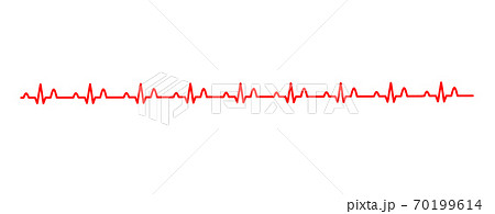 正常な心電図波形イメージ 白バック P波 Qrs波 T波 U波 Pngデータありのイラスト素材
