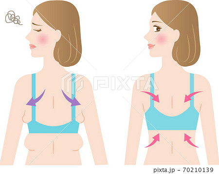 背中 わき肉 ビフォアアフター 女性 背中 わき肉 ビフォアアフター 女性 70210139
