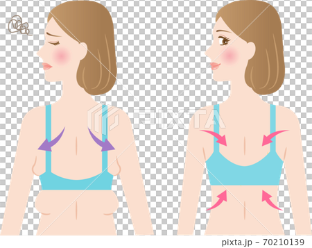 背中 わき肉 ビフォアアフター 女性 背中 わき肉 ビフォアアフター 女性 70210139