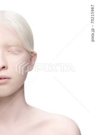 Portrait of beautiful albino woman isolated on white studio background. Beauty, fashion, skincare, cosmetics concept. Portrait of beautiful albino woman isolated on white studio background. Beauty, fashion, skincare, cosmetics concept. 70215967