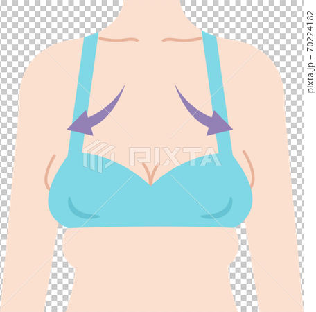 離れ乳 女性 ビフォアアフター 離れ乳 女性 ビフォアアフター 70224182