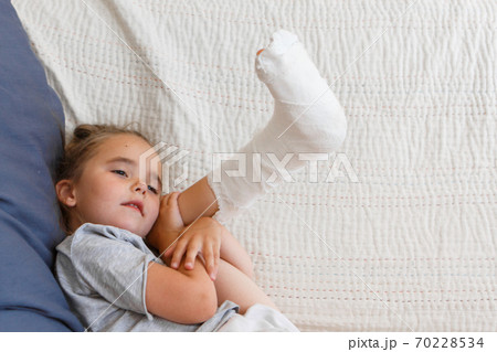 broken leg. Close-up of the cast on the feet. exercises to repair and strengthen muscles. damage to the bones. medical care of a surgeon in the emergency room 70228534