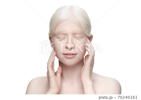 Portrait of beautiful albino woman isolated on white studio background. Beauty, fashion, skincare, cosmetics concept. Portrait of beautiful albino woman isolated on white studio background. Beauty, fashion, skincare, cosmetics concept. 70240161