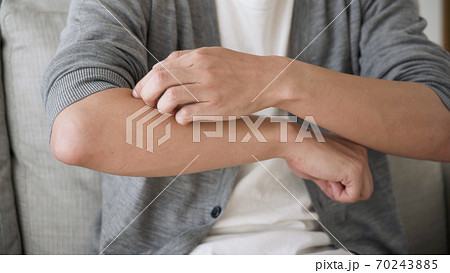 腕をかく若い男性	 70243885