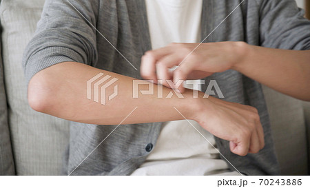 腕をかく若い男性	 70243886