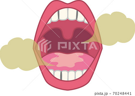 虫歯のイラストのイラスト素材