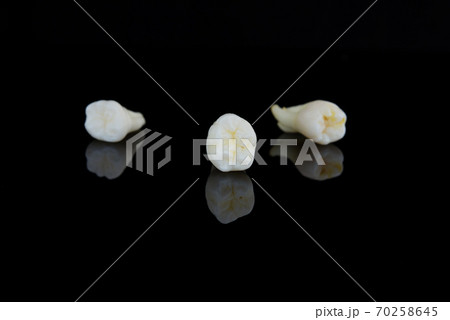 Three torn human teeth on a black background. Close-up photo of spoiled molars and premolars. Selective focus. Three torn human teeth on a black background. Close-up photo of spoiled molars and premolars. Selective focus. 70258645