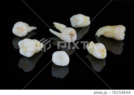 Torn human teeth on a black background. Close-up photo of spoiled molars and premolars. Selective focus. 70258646