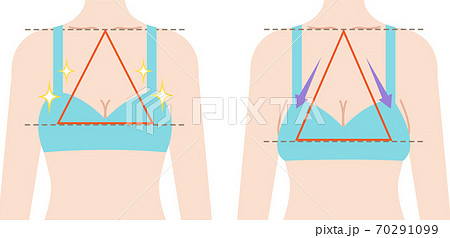 きれいなバスト 垂れたバスト ビフォアアフターのイラスト素材