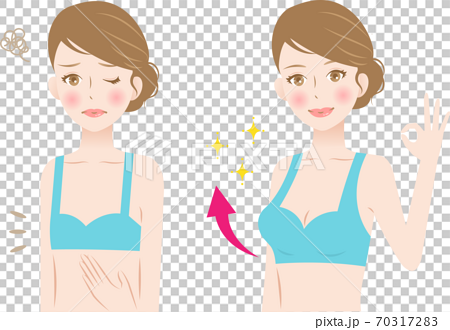 Bust up before after woman - Stock Illustration [70317283] - PIXTA