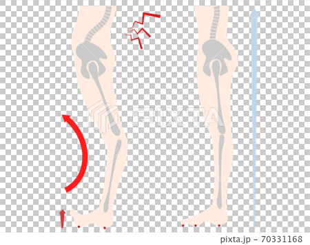 Comparison set of lower body and bone distortion of floating fingers 70331168