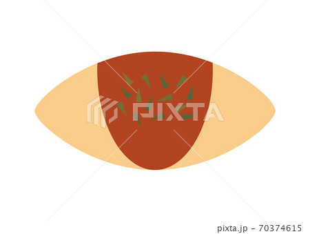 オムライスのイラスト 70374615