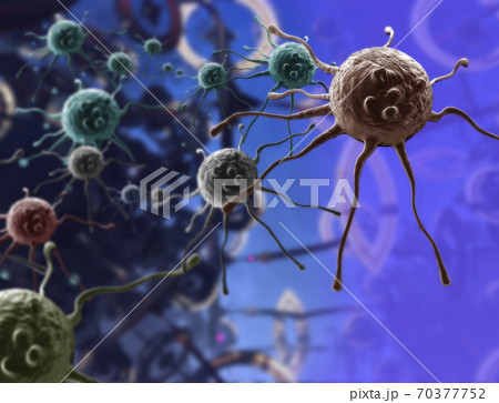 Digital 3d illustration of cancer cells in human body 70377752